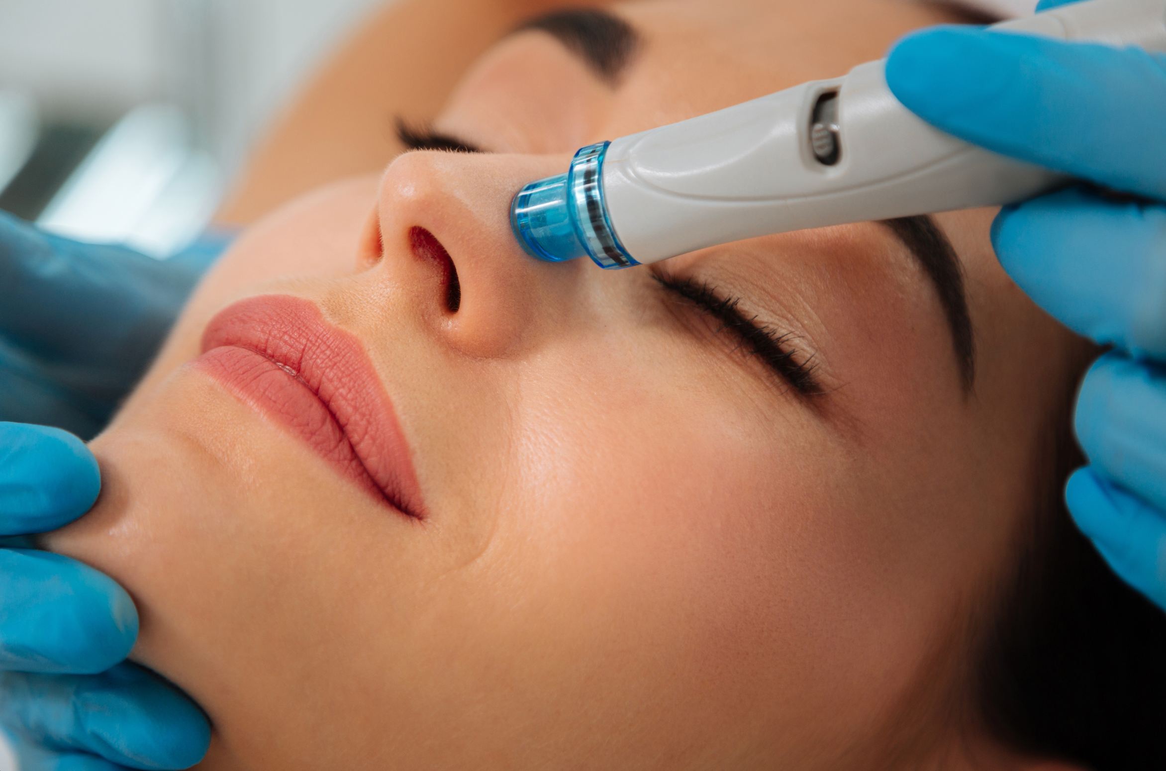 HYDRAFACIAL Treatment