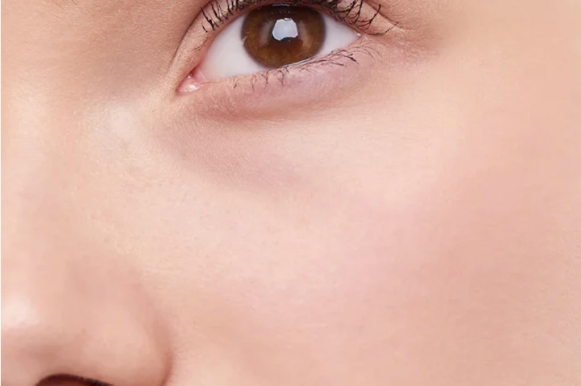 Thermoclear Radio Frequency