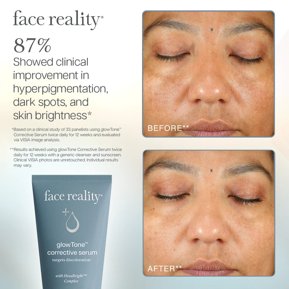 Face Reality Skincare | GlowTone™ Corrective Serum Results