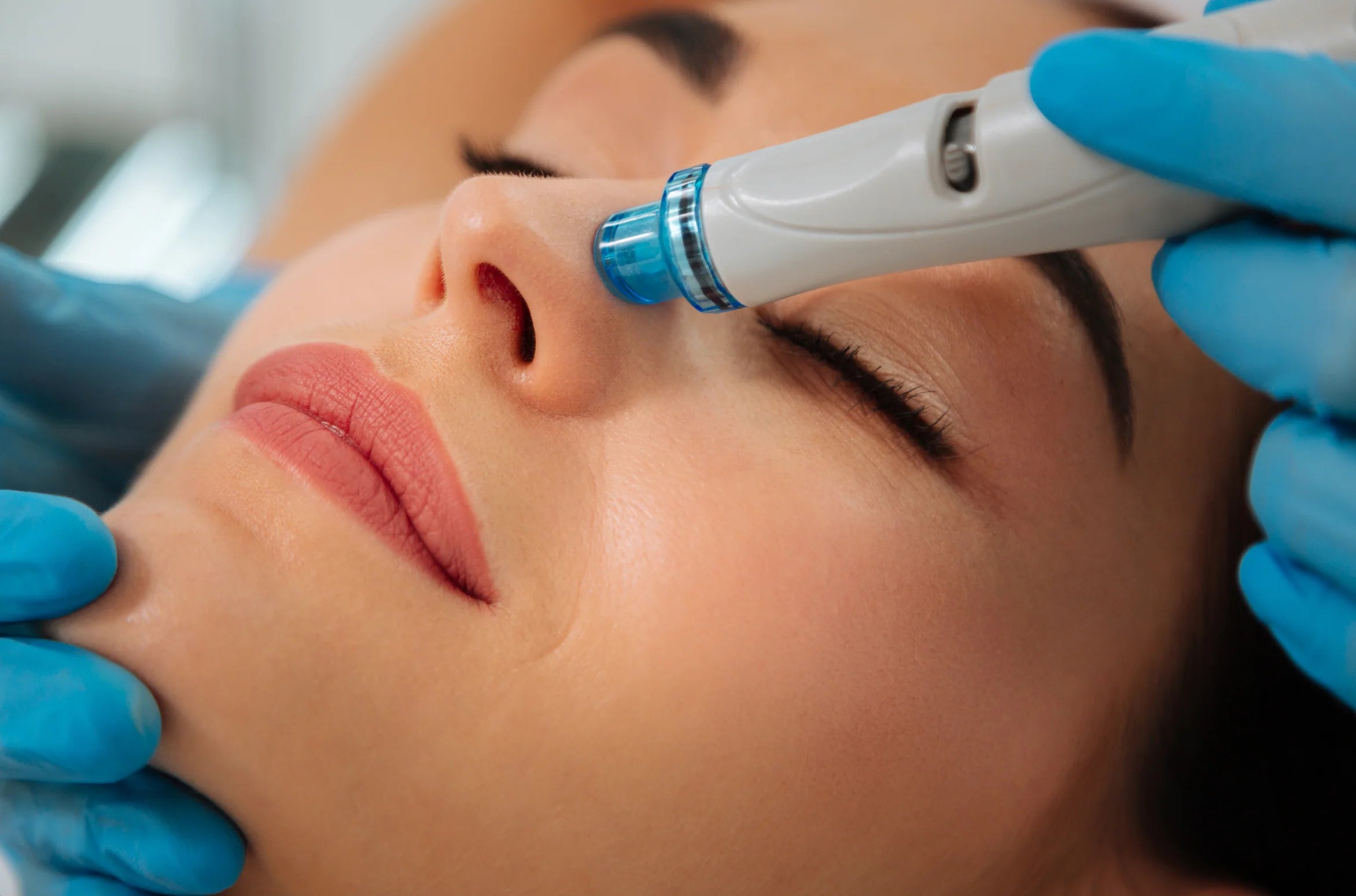 Hydrafacial Services in Vail Colorado
