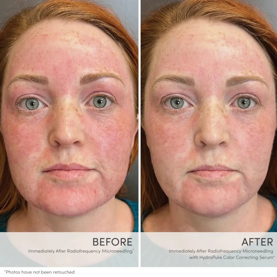 Jane Iredale HydroPure™ Color Correcting Serum with Hyaluronic Acid & CoQ10