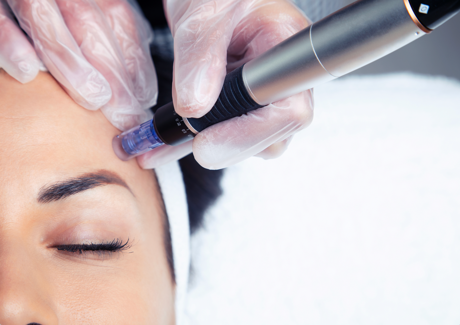 MICRO-NEEDLING FACIAL Treatments