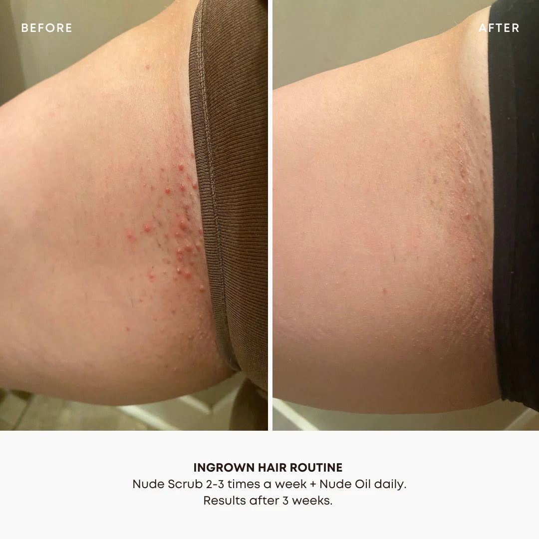 Bushbalm | Ingrown Hair + Pre-Post Wax Oil Result