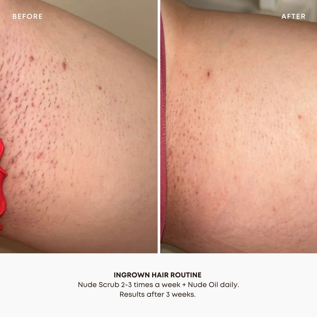 Bushbalm | Ingrown Hair + Pre-Post Wax Oil Before And After