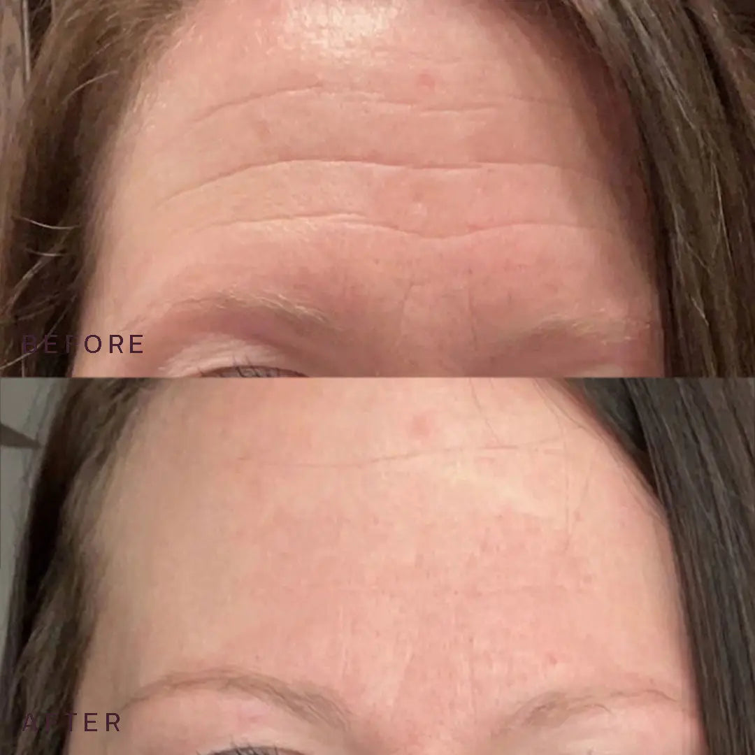 Dermaclara | Ageless Beauty Bundle Before And After