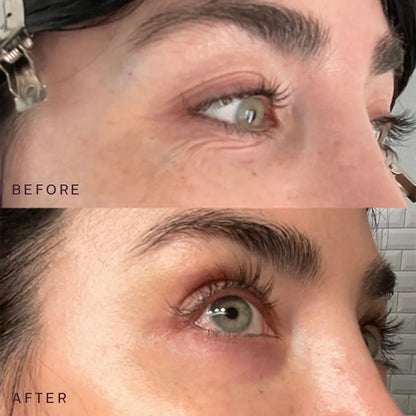 Dermaclara | Ageless Beauty Bundle Before And After Results