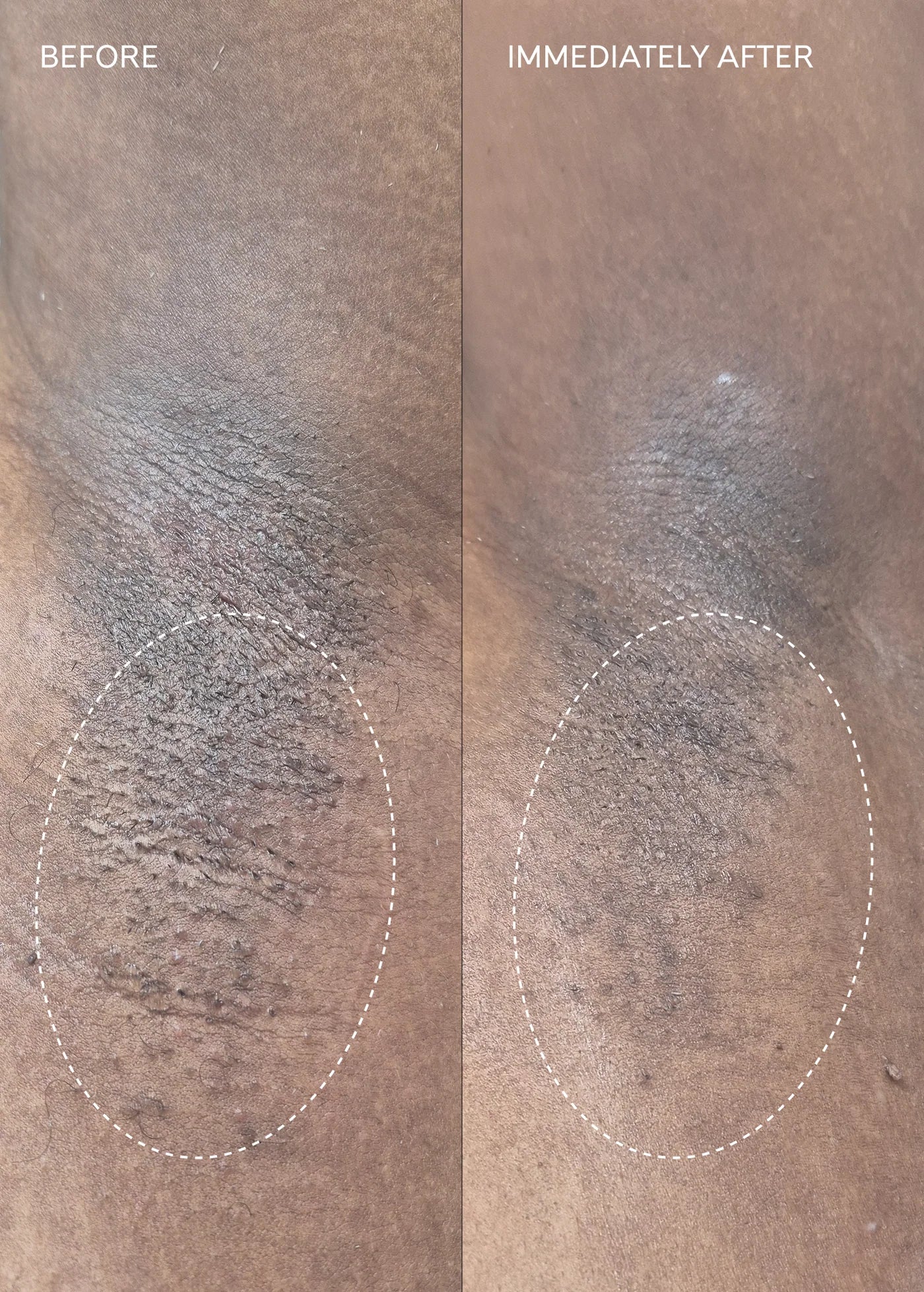 Fur Flash Repair Jelly Before and After Results