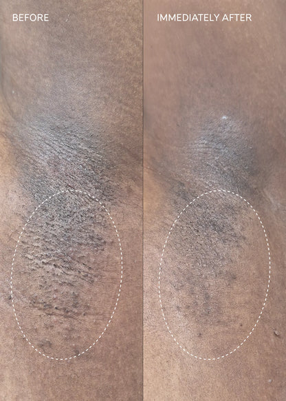 Fur Flash Repair Jelly Before and After Results