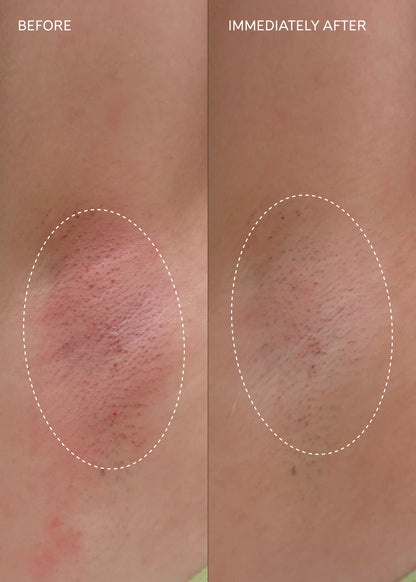 Fur Flash Repair Jelly cooling gel for waxing and shaving