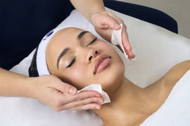 Prodigy Peel Systems